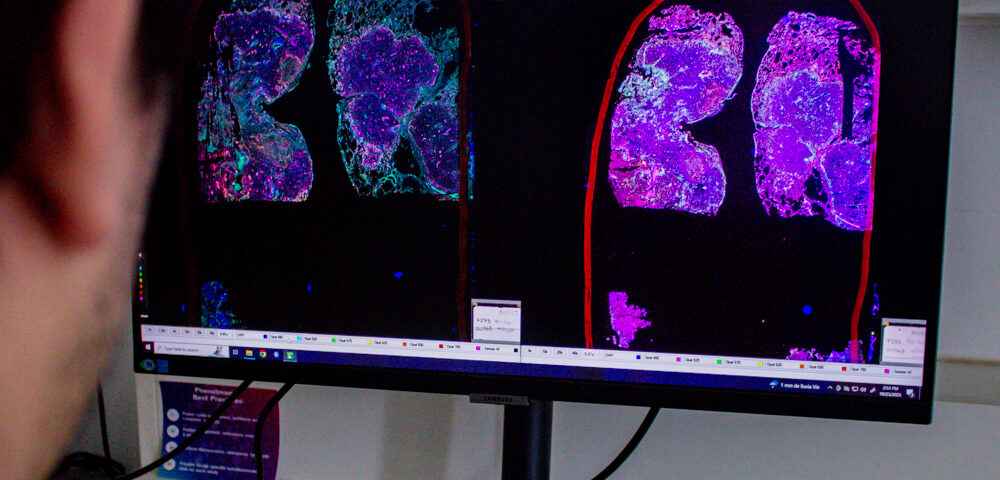 #caption0 “Mes rosa” en la FCQ: equipos científicos avanzan en estudios sobre cáncer de mama