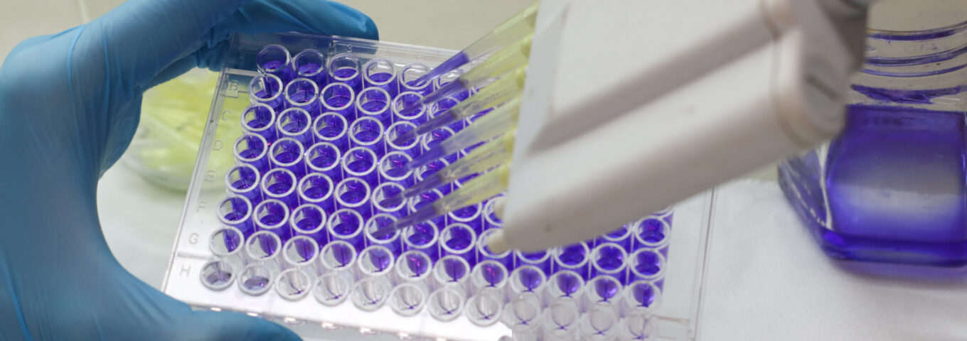 Inscripciones a la Especialización en Química Ambiental y a las Especializaciones en Bioquímica Clínica áreas Bacteriología, Virología, Parasitología y Endocrinología