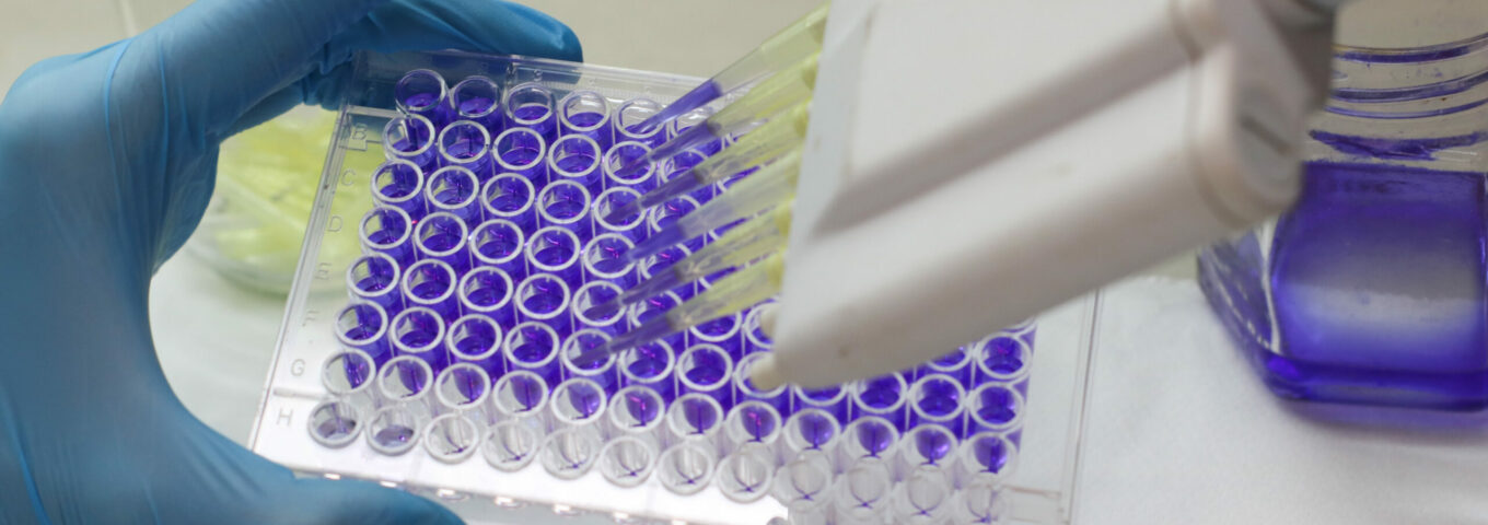 Inscripciones a la Especialización en Química Ambiental y a las Especializaciones en Bioquímica Clínica áreas Bacteriología, Virología, Parasitología y Endocrinología